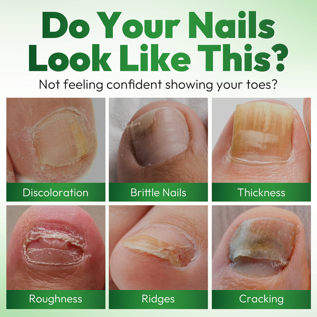 VERDORA FIXLAB Fungal Nail Care Solution