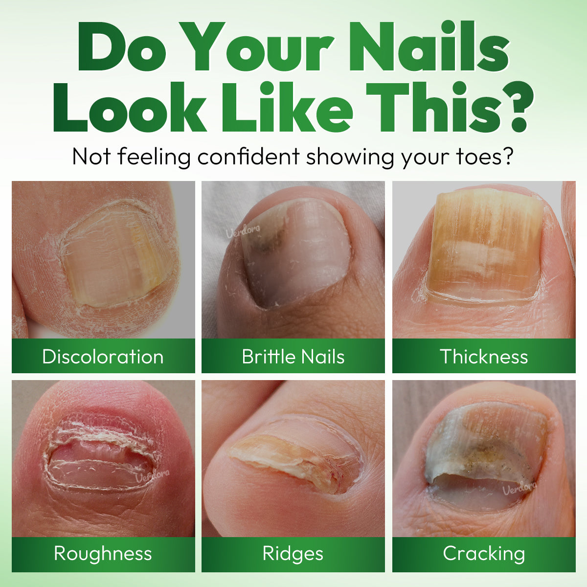 VERDORA FIXLAB Fungal Nail Care Solution