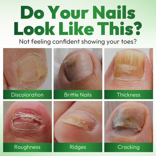 VERDORA FIXLAB Fungal Nail Care Solution