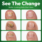 VERDORA Tea Tree Oil Fungal Nail Care Solution