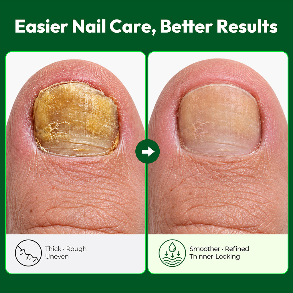 Ponceuse à ongles électrique VERDORA pour ongles épais