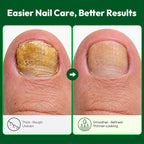 Ponceuse à ongles électrique VERDORA pour ongles épais
