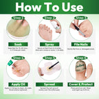 Kit de soin des ongles VERDORA pour le traitement des mycoses des ongles
